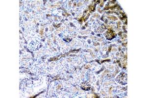IHC analysis of CD2AP using anti-CD2AP antibody (ABIN6719544).