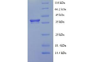 SDS-PAGE (SDS) image for Heme Binding Protein 2 (HEBP2) (AA 2-205) protein (His-SUMO Tag) (ABIN4974502) (HEBP2 Protein (AA 2-205) (His-SUMO Tag))