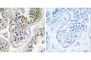 Peptide - +Immunohistochemistry analysis of paraffin-embedded human testis tissue using ATXN7L1 antibody. (ATXN7L1 antibody)