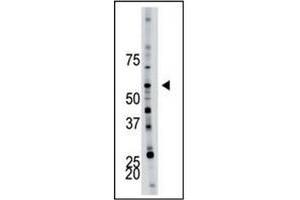 Image no. 1 for anti-6-phosphofructo-2-Kinase/fructose-2,6-Biphosphatase 4 (PFKFB4) (AA 274-303) antibody (ABIN360670) (PFKFB4 antibody  (AA 274-303))