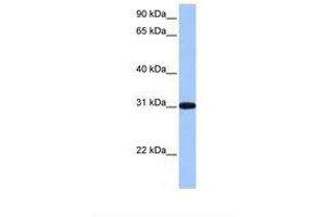 Image no. 1 for anti-Ret Finger Protein-Like 2 (RFPL2) (C-Term) antibody (ABIN6738815) (RFPL2 antibody  (C-Term))