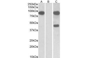 HEK293 lysate (10ug protein in RIPA buffer) overexpressing Human Numbl with C-terminal MYC tag probed with ABIN5539874 (1ug/ml) in Lane A and probed with anti-MYC Tag (1/1000) in lane C. (NUMBL antibody  (N-Term))