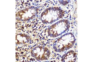 Immunohistochemistry of paraffin-embedded Human colon using  Rabbit pAb (ABIN6133192, ABIN6137243, ABIN6137244 and ABIN6223255) at dilution of 1:100 (40x lens). (ATG10 antibody  (AA 1-220))