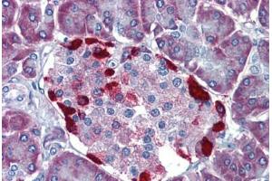 Pancreas, Human: Formalin-Fixed, Paraffin-Embedded (FFPE) (LRRN4 antibody  (N-Term))