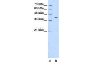 Western Blotting (WB) image for anti-Pregnancy Specific beta-1-Glycoprotein 6 (PSG6) antibody (ABIN2462492) (PSG6 antibody)