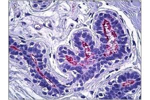 Human Breast, Epithelium: Formalin-Fixed, Paraffin-Embedded (FFPE) (Moesin antibody  (C-Term))