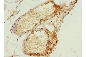 Immunohistochemistry of paraffin-embedded human plasma tissue using ABIN7155026 at dilution of 1:100 (SERPIND1 antibody  (AA 20-290))