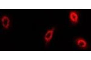 Immunofluorescent analysis of sPLA2-IID staining in U2OS cells. (PLA2G2D antibody)