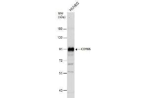 WB Image Whole cell extract (30 μg) was separated by 7. (Endoglin antibody)
