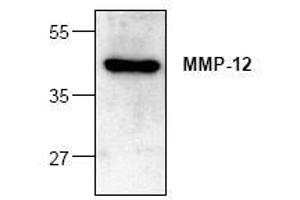 Image no. 1 for anti-Matrix Metallopeptidase 12 (Macrophage Elastase) (MMP12) antibody (ABIN127325)
