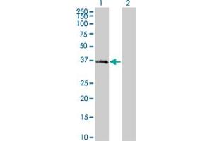 Western Blot analysis of MEOX2 expression in transfected 293T cell line by MEOX2 monoclonal antibody (M10), clone 4E10.