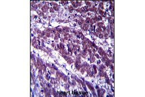 OGDH Antibody (C-term) (ABIN657365 and ABIN2846412) immunohistochemistry analysis in formalin fixed and paraffin embedded human heart tissue followed by peroxidase conjugation of the secondary antibody and DAB staining. (alpha KGDHC antibody  (C-Term))