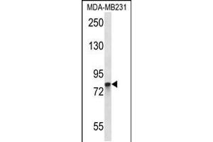 Western blot analysis in MDA-MB231 cell line lysates (35ug/lane). (PADI2 antibody  (C-Term))