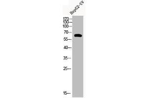 Western Blot analysis of HEPG2-UV cells using Acetyl-Cortactin (K235) Polyclonal Antibody (Cortactin antibody  (acLys235))