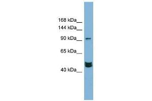 Western Blot showing MAML3 antibody used at a concentration of 1-2 ug/ml to detect its target protein. (MAML3 antibody  (Middle Region))