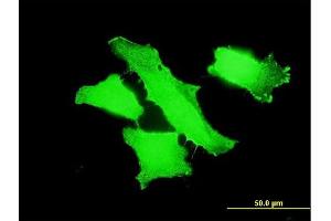 Immunofluorescence of monoclonal antibody to MPP1 on HeLa cell. (MPP1 antibody  (AA 1-466))