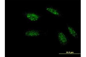 Immunofluorescence of monoclonal antibody to TWIST1 on HeLa cell. (TWIST1 antibody  (AA 100-202))