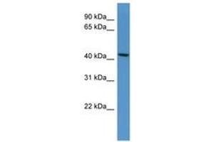 Image no. 1 for anti-UDP-Gal:betaGlcNAc beta 1,4- Galactosyltransferase, Polypeptide 5 (B4GALT5) (AA 311-360) antibody (ABIN6746272) (B4GALT5 antibody  (AA 311-360))