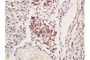 Immunohistochemistry (Paraffin-embedded Sections) (IHC (p)) image for anti-Hematopoietic Cell-Specific Lyn Substrate 1 (HCLS1) (AA 161-260) antibody (ABIN709811)