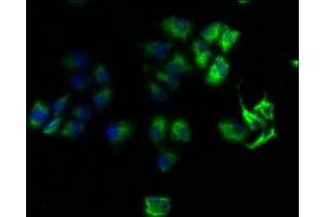 Immunofluorescence staining of Hela cells with ABIN7167999 at 1:100, counter-stained with DAPI. (ROCK1 antibody  (AA 405-668))
