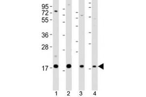 Western blot testing of Shh antibody at 1:2000 dilution.