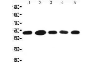Anti-HSC70 Interacting Protein HIP antibody, Western blotting Lane 1: A431 Cell Lysate Lane 2: HELA Cell Lysate Lane 3: 293T Cell Lysate Lane 4: JURKAT Cell Lysate Lane 5: MCF-7 Cell Lysate (HSC70 Interacting Protein HIP antibody  (N-Term))