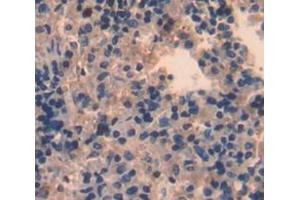 Used in DAB staining on fromalin fixed paraffin- embedded Kidney tissue (STAP1 antibody  (AA 1-297))