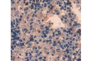 Used in DAB staining on fromalin fixed paraffin- embedded Kidney tissue (STAP1 antibody  (AA 1-297))