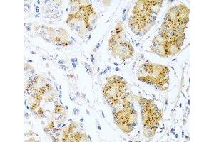 Immunohistochemistry of paraffin-embedded Human stomach using Endothelin 1 Polyclonal Antibody at dilution of 1:100 (40x lens). (Endothelin 1 antibody)