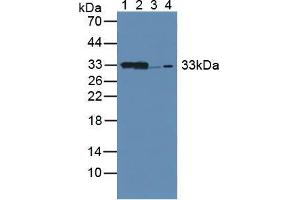 Western blot analysis of (1) Mouse Kidney Tissue, (2) Mouse Liver Tissue, (3) Rat Kidney Tissue and (4) Human 293T Cells. (CBR1 antibody  (AA 66-271))