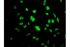 Immunofluorescence of monoclonal antibody to ID1 on HeLa cell. (ID1 antibody  (AA 1-155))