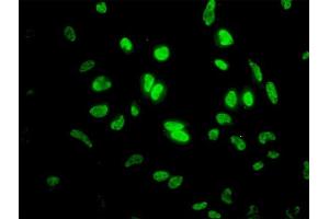 Immunofluorescence of monoclonal antibody to ID1 on HeLa cell.