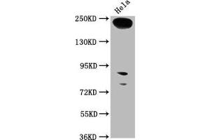 Western Blot Positive WB detected in: Hela whole cell lysate All lanes: RTTN antibody at 1:1000 Secondary Goat polyclonal to rabbit IgG at 1/50000 dilution Predicted band size: 249, 68, 246, 99 kDa Observed band size: 249 kDa (Rotatin (RTTN) (AA 1509-1603) antibody)