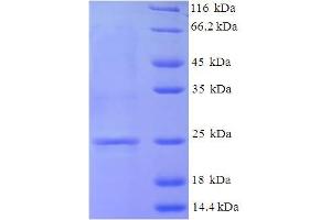 SDS-PAGE (SDS) image for Natriuretic Peptide Receptor B/guanylate Cyclase B (Atrionatriuretic Peptide Receptor B) (NPR2) (AA 37-112) protein (His-SUMO Tag) (ABIN5711255)