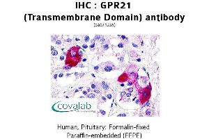 Image no. 2 for anti-G Protein-Coupled Receptor 21 (GPR21) antibody (ABIN1735029)