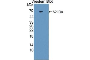 WB of Protein Standard: different control antibodies against Highly purified E. (Prothrombin Fragment 1+2 ELISA Kit)
