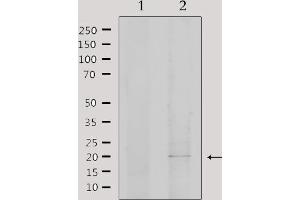 Western blot analysis of extracts from 293, using EID1 Antibody. (EID1 antibody  (Internal Region))