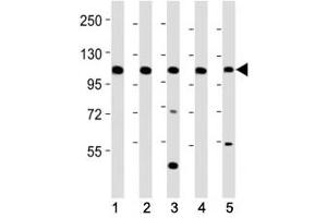 Western blot testing of Mertk antibody at 1:2000 dilution. (MERTK antibody  (C-Term))