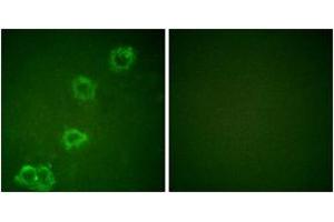 Immunofluorescence analysis of HuvEc cells, using BACE (Ab-498) Antibody.