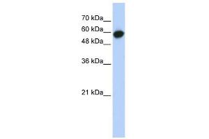 LRRC6 antibody used at 1 ug/ml to detect target protein. (LRRC6 antibody  (Middle Region))