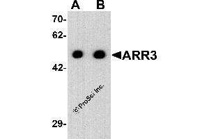Western Blotting (WB) image for anti-Arrestin 3, Retinal (X-Arrestin) (ARR3) (C-Term) antibody (ABIN2457884) (ARR3 antibody  (C-Term))