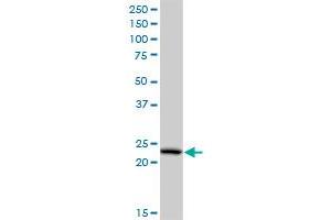 PCTP monoclonal antibody (M03), clone 3A11. (PCTP antibody  (AA 106-214))