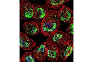 Fluorescent confocal image of U251 cell stained with KLF5 Antibody . (KLF5 antibody  (C-Term))