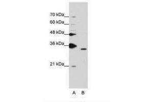 Image no. 2 for anti-Peptidylprolyl Isomerase E (Cyclophilin E) (PPIE) (AA 103-152) antibody (ABIN203046) (PPIE antibody  (AA 103-152))