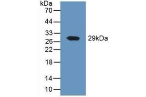 Detection of Recombinant DPP4, Human using Polyclonal Antibody to Cluster Of Differentiation 26 (CD26) (DPP4 antibody  (AA 484-728))