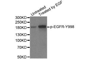 Western Blotting (WB) image for anti-Epidermal Growth Factor Receptor (EGFR) (pTyr1172) antibody (ABIN1870117) (EGFR antibody  (pTyr1172))