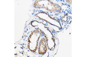 Immunohistochemistry of paraffin-embedded Mouse kidney using /// Rabbit pAb (ABIN7265627) at dilution of 1:50 (40x lens). (ANT1+ANT2+ANT3+ANT4 (C-Term) antibody)