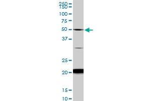 NADK monoclonal antibody (M01), clone 5F4. (NADK antibody  (AA 1-446))
