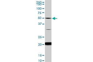 NADK monoclonal antibody (M01), clone 5F4. (NADK antibody  (AA 1-446))