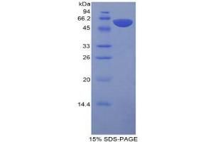 SDS-PAGE (SDS) image for Protein S (PROS) (AA 261-496) protein (His tag,GST tag) (ABIN2123542)